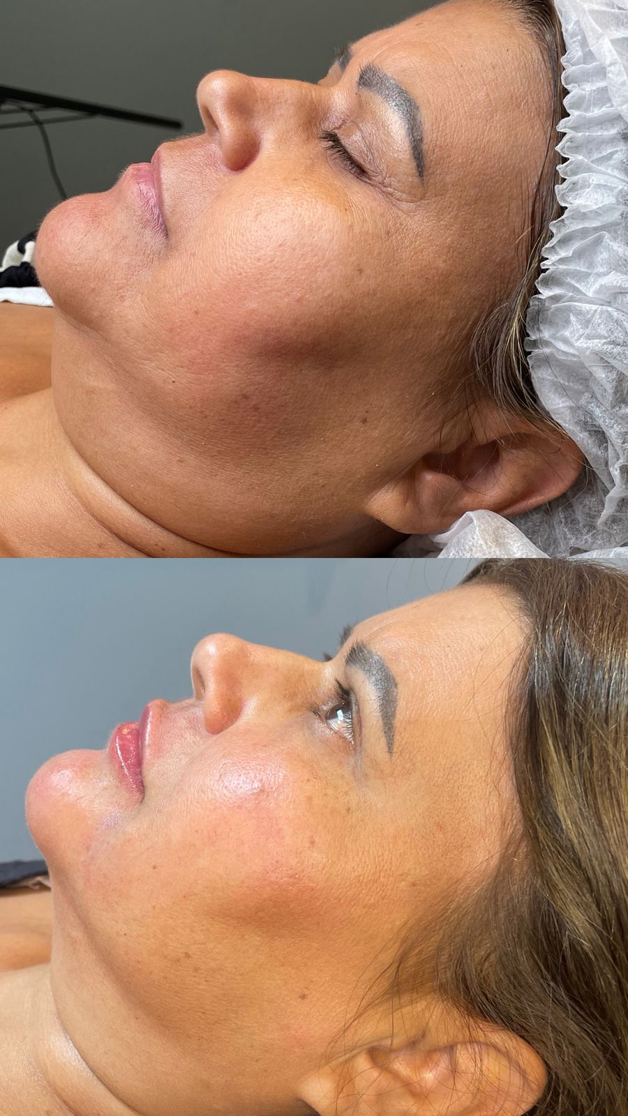 Ultraforme